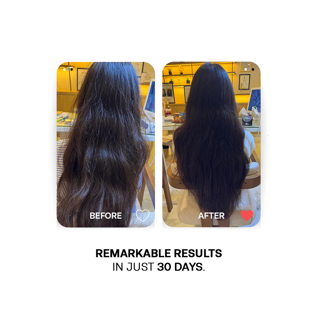 30 Days Hair Growth Trio -  Deal of The Year - Avail Flat 25% Off - Image 4