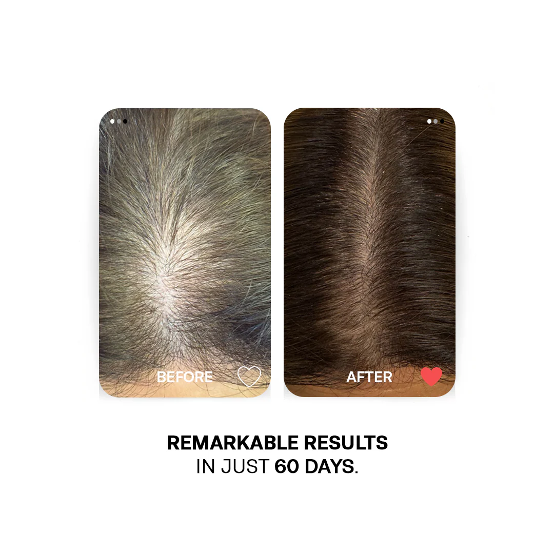 Extreme Hair Growth Oils Bundle - Image 4