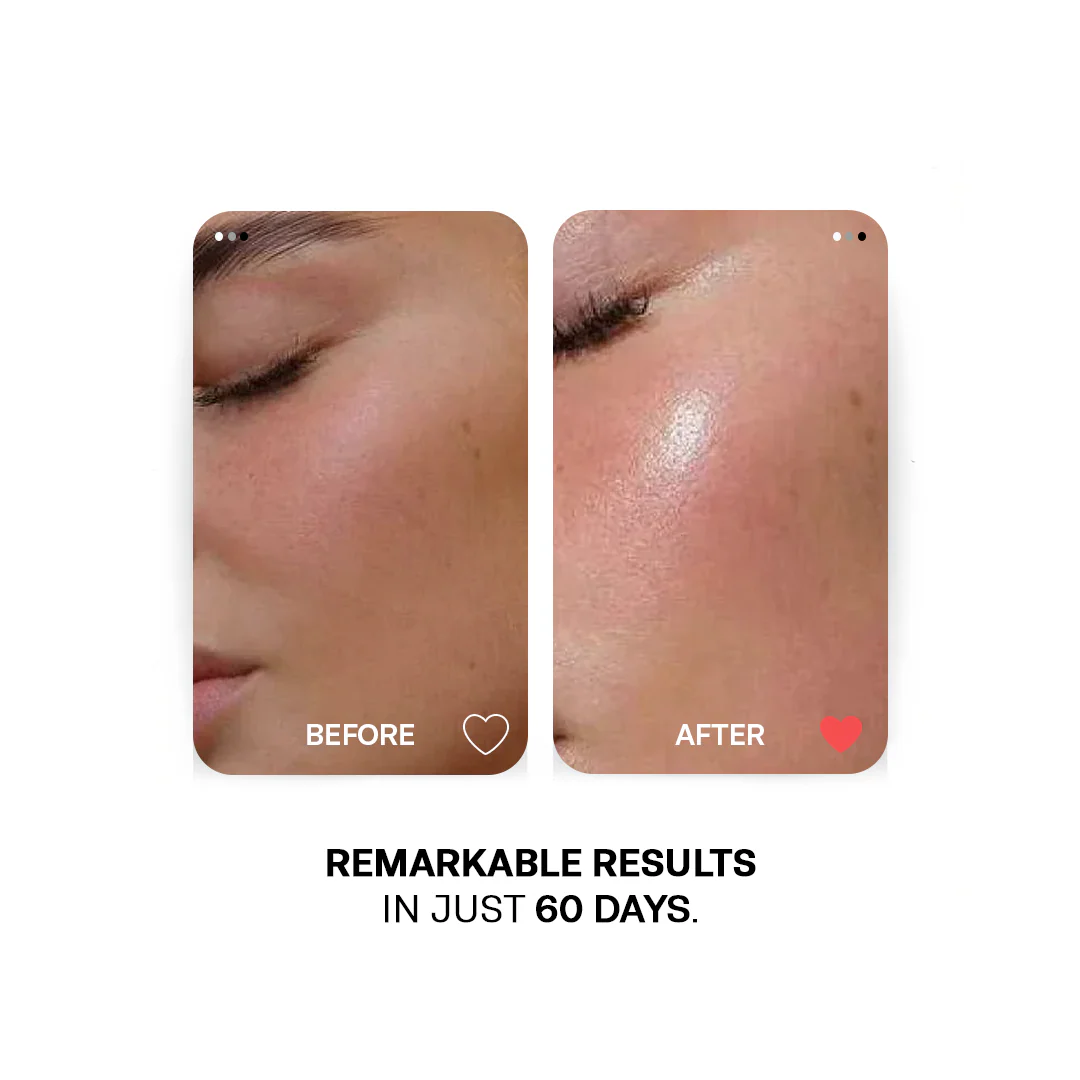 60 Days Skin Care Challenge - Image 4