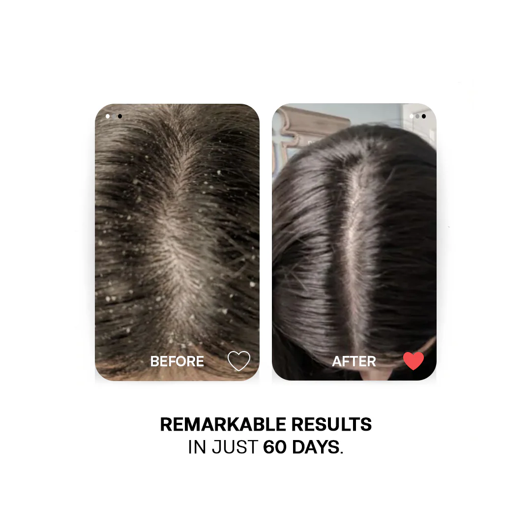 Flake Free Duo - Image 4