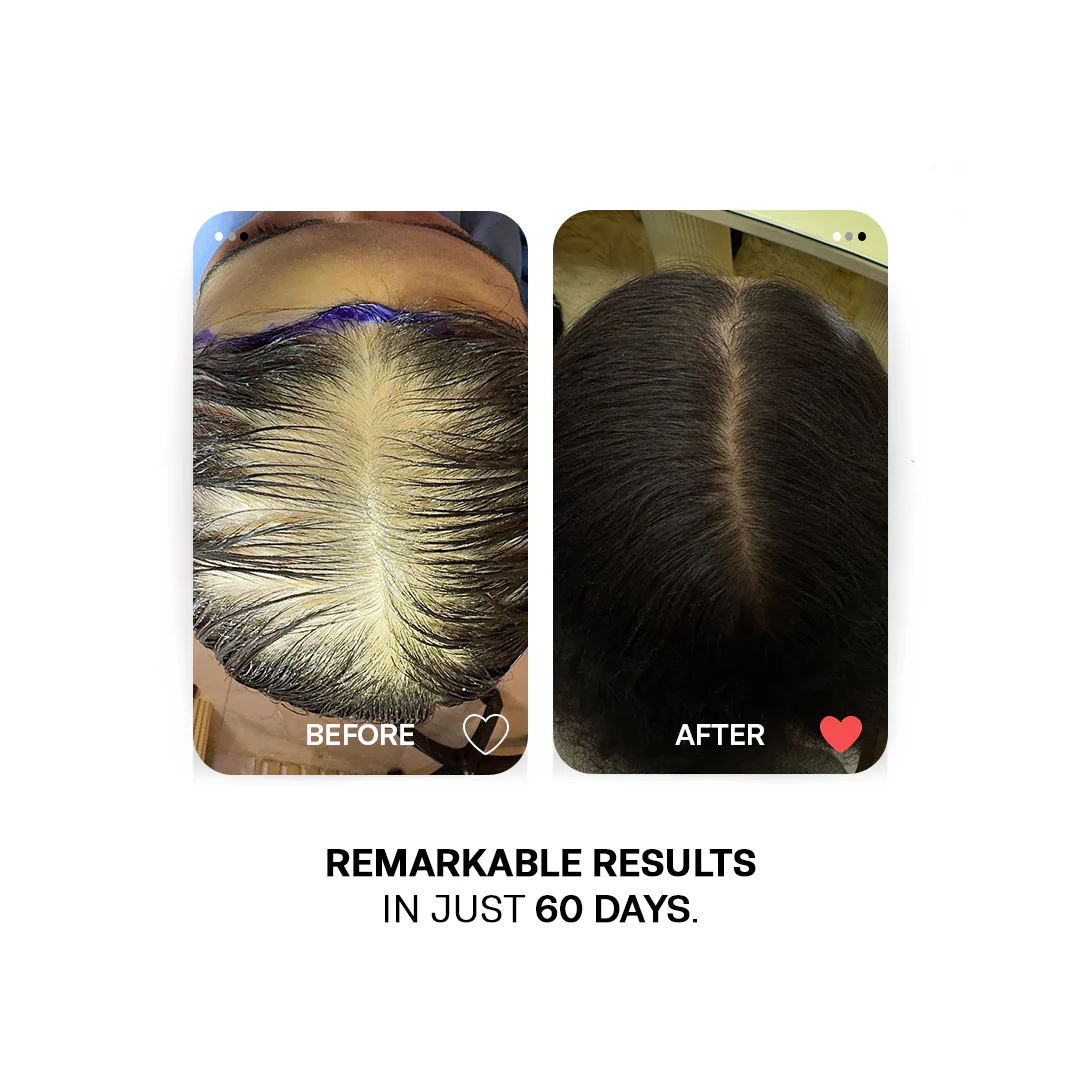 Hair growth Must Haves - Image 4