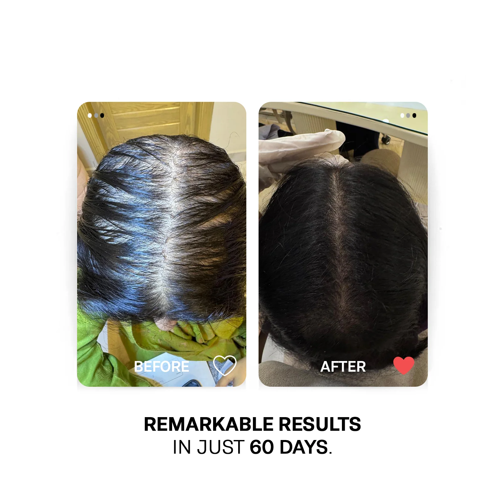 GroPlus - Hair Nails & Skin Supplements | Advanced Hair Growth Supplements - Image 4