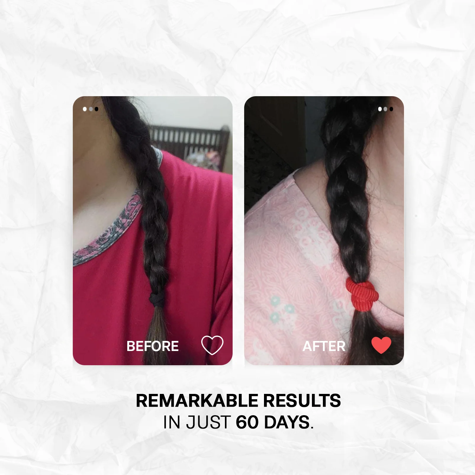 Medicated Hair Loss Advanced Solution - Image 4