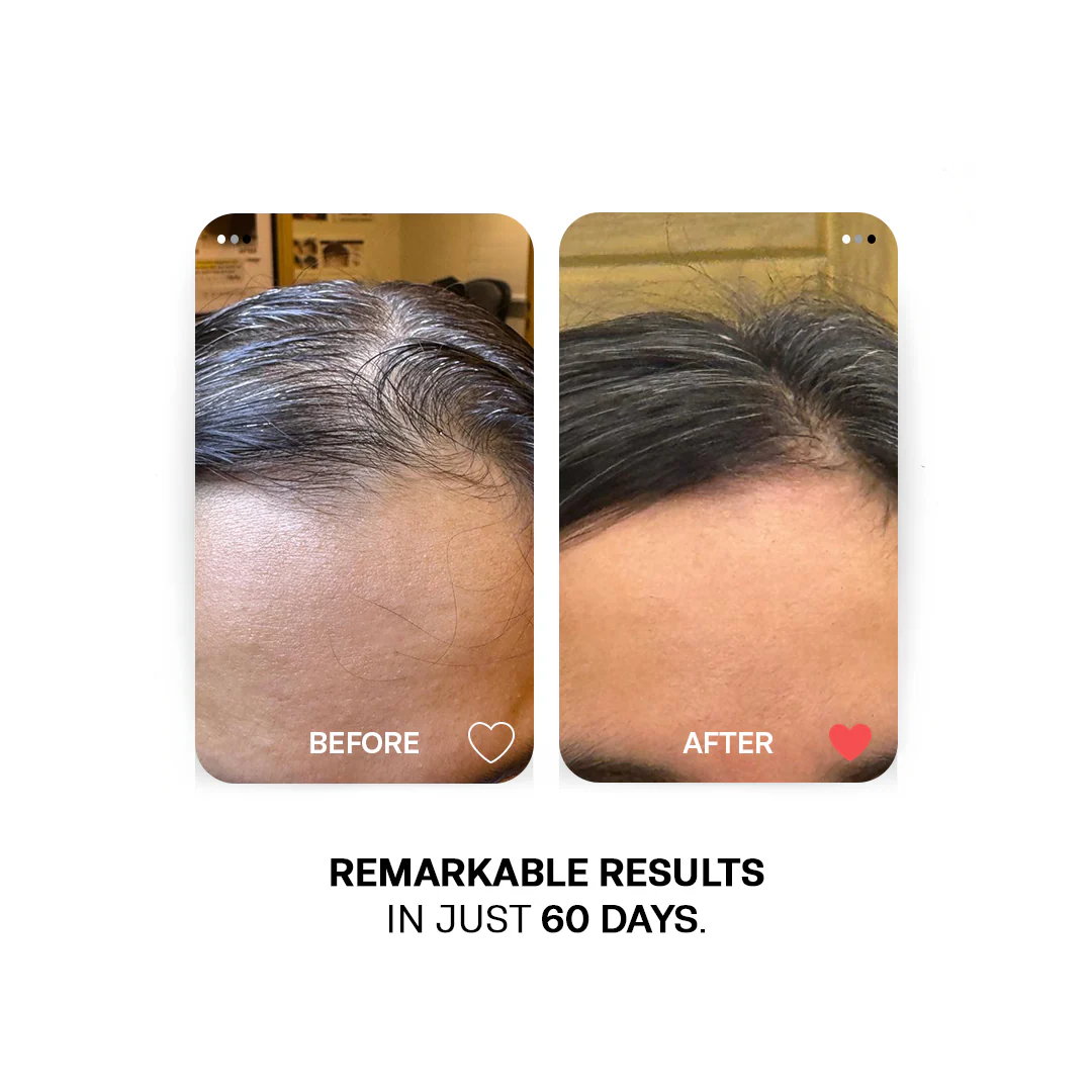 Nourishing Hair Trio Bundle: 3-Oil Bundle for Healthy, Vibrant Locks - Image 4