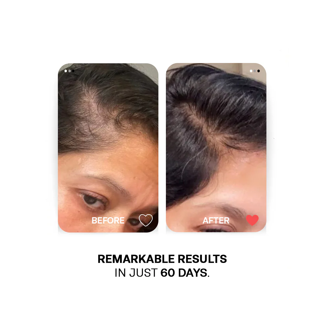 Onion Essential Oil - Scalp Repair Root Strengthening - Image 4