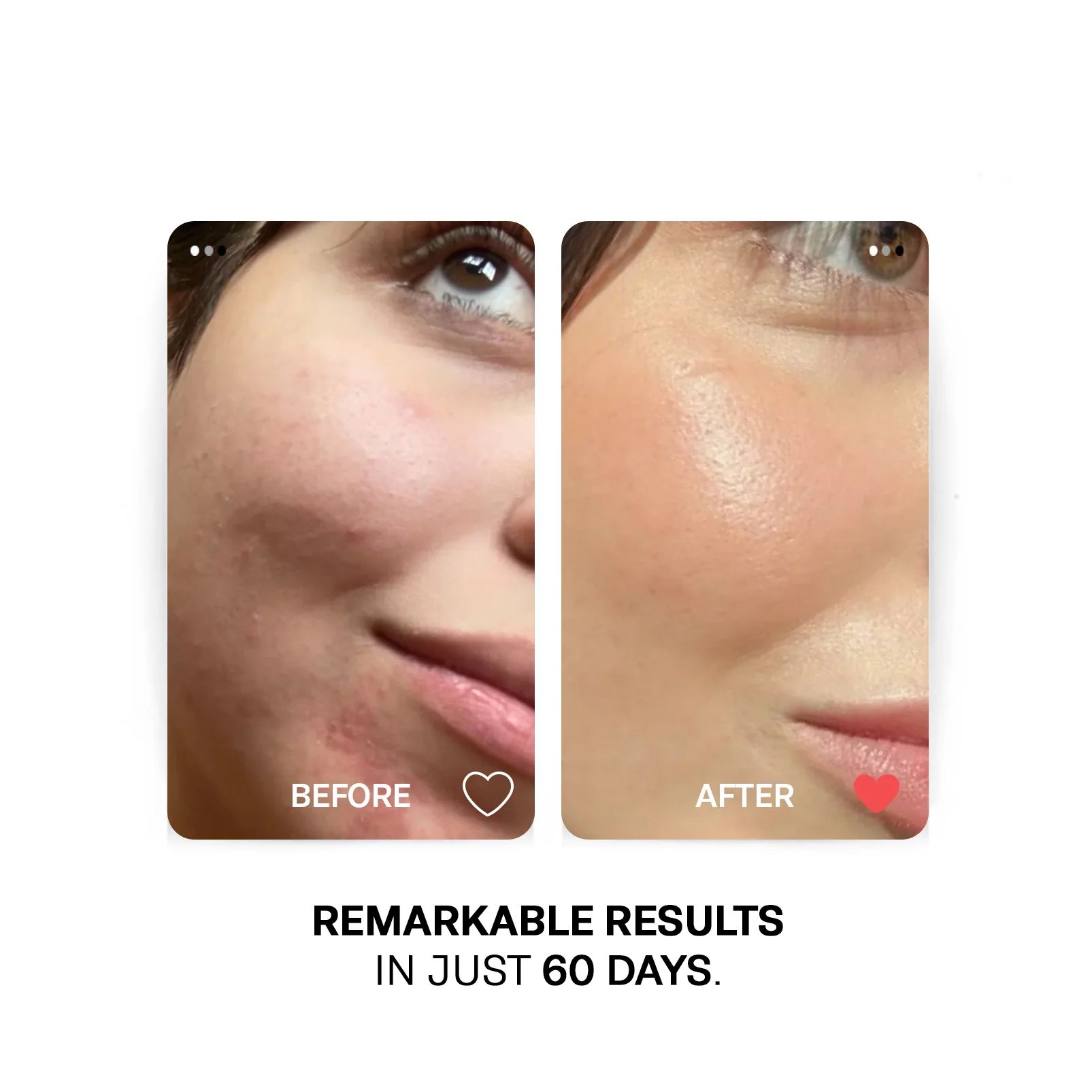 Radiance Boosting Facial Oil - Image 4