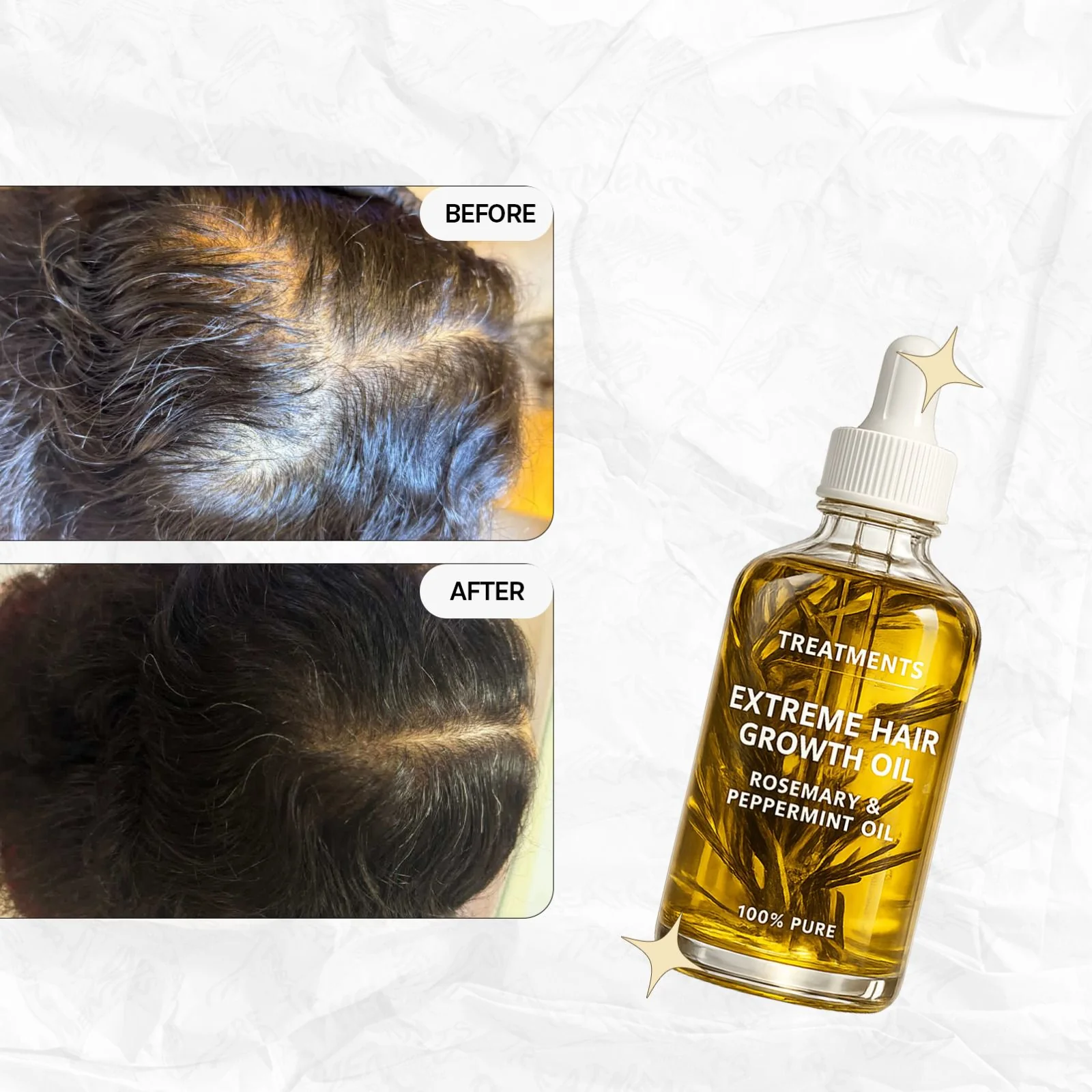 Rosemary Hair Oil - Image 4
