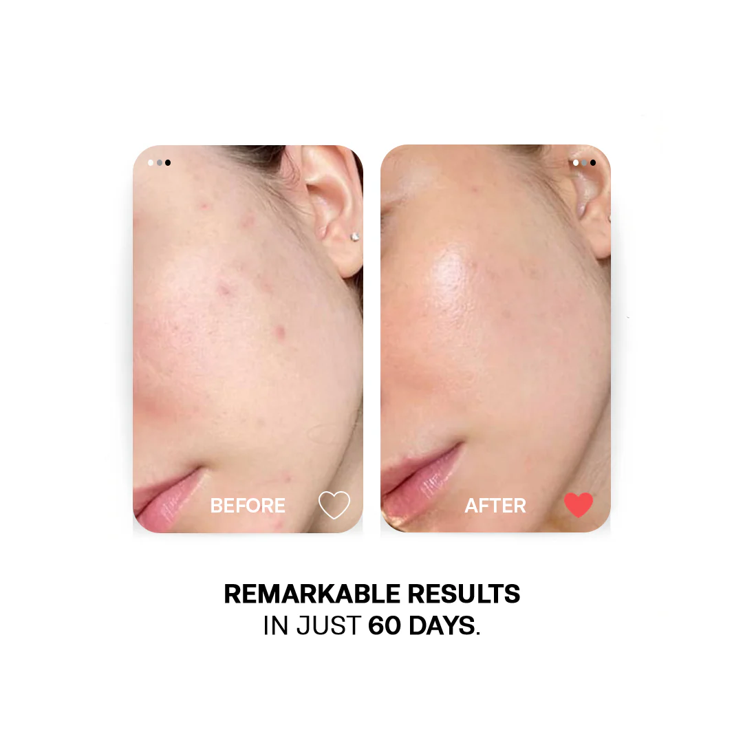 Vitamin E Essential Oil - Antioxidant Repair Skin & Hair Nourishment - Image 4